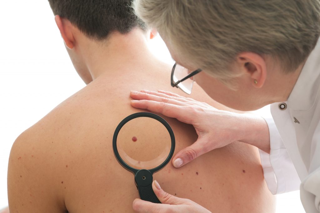 کراتوز سبورئیک چگونه تشخیص داده می شود؟